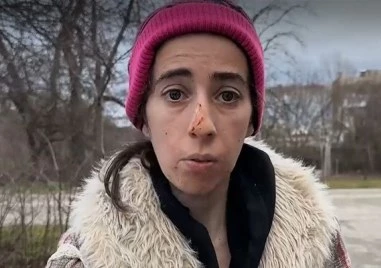 Млада жена е пострадала при нападение от агресивно куче в