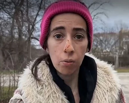 Агресивно куче нахапа жена в Казанлък