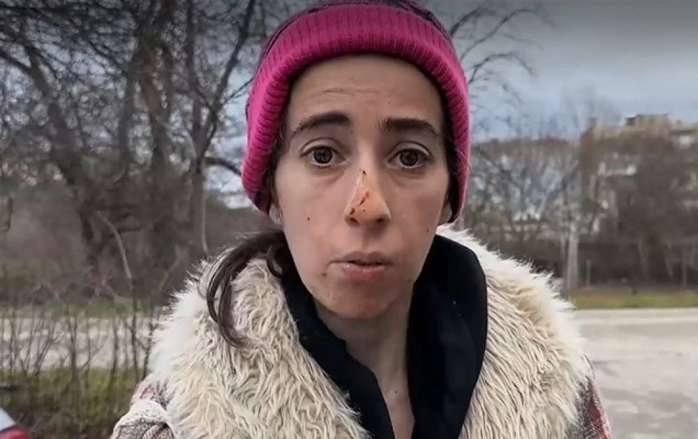 Агресивно куче нахапа жена в Казанлък