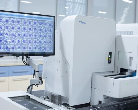 Изследвания за диабет, щитовидна жлеза и автоимунитет в лаборатория „ЛИНА