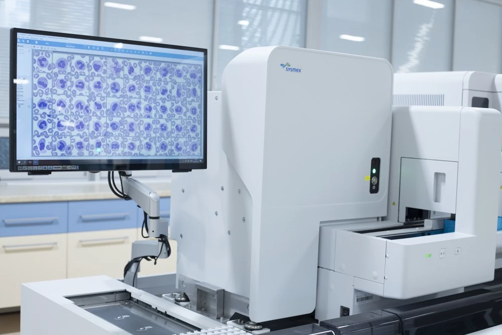 Изследвания за диабет, щитовидна жлеза и автоимунитет в лаборатория „ЛИНА