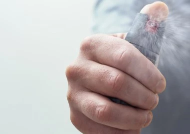 Задържаха младеж, напръскал с лютив спрей шофьор след разминаване на улица в Пловдив