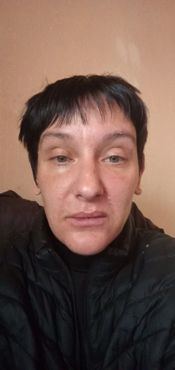 Състоянието на 43-годишна жена се влошава след дентална интервенция, търси помощ за лечение в чужбина