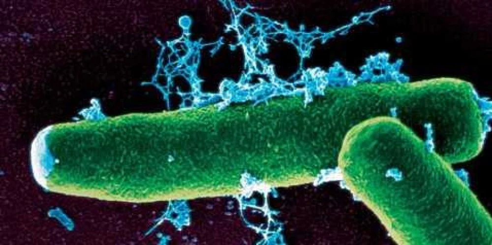 24 души са под постоянно медицинско наблюдение и се лекуват превантивно с антибиотици заради случая с антракс