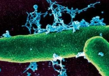 24 души са под постоянно медицинско наблюдение и се лекуват превантивно с антибиотици заради случая с антракс