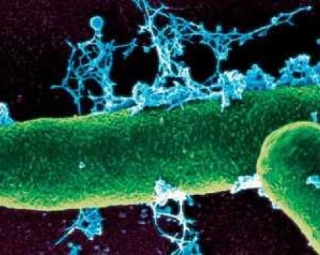 24 души са под постоянно медицинско наблюдение и се лекуват превантивно с антибиотици заради случая с антракс