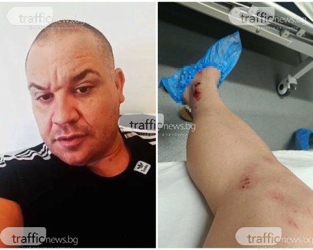 Тошо Куката е в болница: Опитаха се да ме убият! Блъснаха ме с кола и ме хвърлиха 7 метра