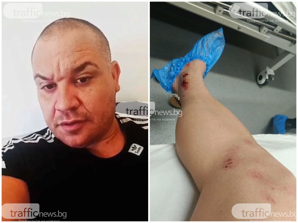 Тошо Куката е в болница: Опитаха се да ме убият! Блъснаха ме с кола и ме хвърлиха 7 метра