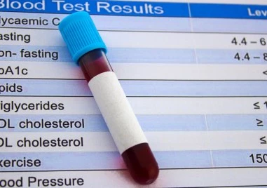 Американската Агенция по храните и лекарствата одобри първия PCSK9 инхибитор