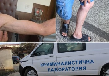 Опит за убийство в Пловдив: Мъж извади нож и наръга съседи без причина, „не разбрал, че ще го съдят