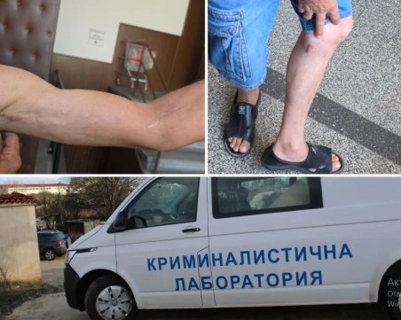 Опит за убийство в Пловдив: Мъж извади нож и наръга съседи без причина, „не разбрал