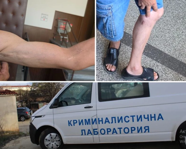 Опит за убийство в Пловдив: Мъж извади нож и наръга съседи без причина, „не разбрал