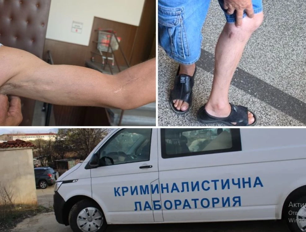 Опит за убийство в Пловдив: Мъж извади нож и наръга съседи без причина, „не разбрал